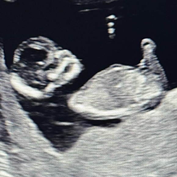 … - Picture 3 of 16